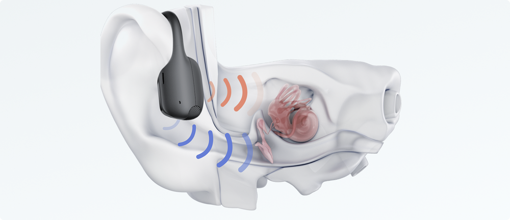 Bone Conduction Device How Bone Conduction Headsets Work Seamlessly with Hearing Aids in the ...